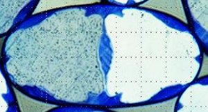 Cross section of thread
