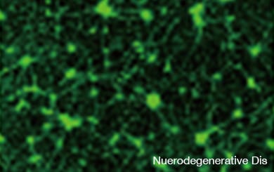 Nuerodegenerative Dis