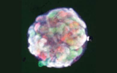 Kidney organoids derived from human iPS cells