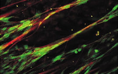 Myelination using rat neurons and Schwann cells
